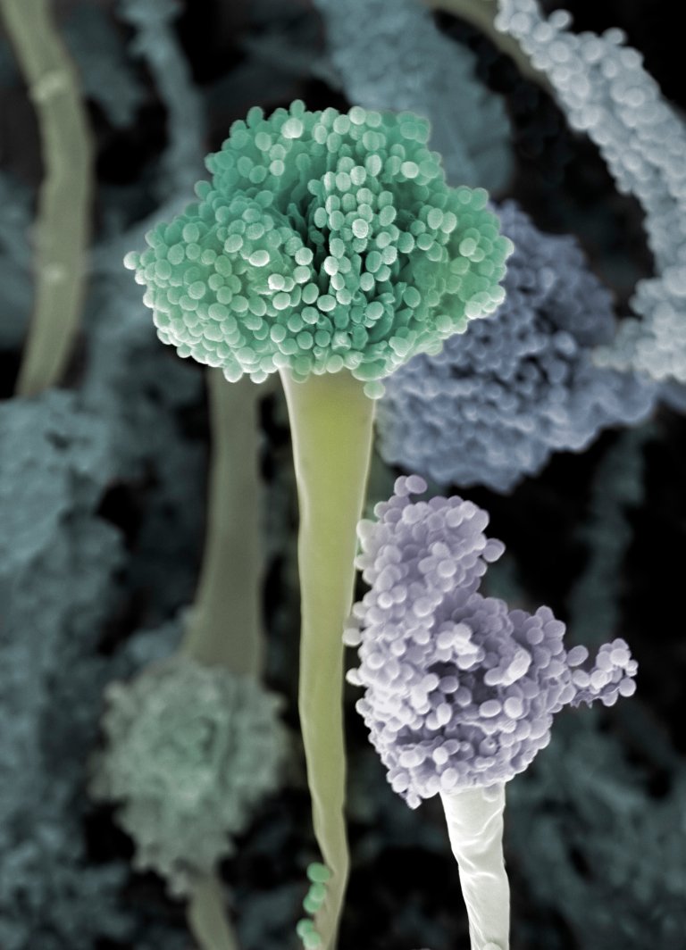 The World Health Organization (WHO) has chosen the fungus Aspergillus fumigatus as a fungus that can pose a health threat in the future. For people with compromised immune systems, the fungus can cause infections that need to be treated. This is what the fungus looks like under an electron microscope. Photo: Jannicke Wiik-Nielsen, Norwegian Veterinary Institute